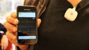 MOBILE ECG TELEMONITORING